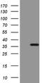ERCC Excision Repair 8, CSA Ubiquitin Ligase Complex Subunit antibody, NBP2-45519, Novus Biologicals, Western Blot image 