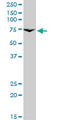 Prolactin Receptor antibody, LS-C198004, Lifespan Biosciences, Western Blot image 