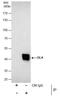 Galactosidase Alpha antibody, PA5-27349, Invitrogen Antibodies, Immunoprecipitation image 