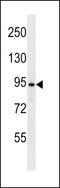 Ubiquitin Specific Peptidase 37 antibody, LS-C160397, Lifespan Biosciences, Western Blot image 