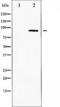 IKK alpha/beta antibody, TA325383, Origene, Western Blot image 