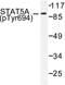 Signal Transducer And Activator Of Transcription 5A antibody, LS-C177958, Lifespan Biosciences, Western Blot image 