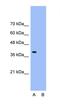 Collagen Type III Alpha 1 Chain antibody, orb304041, Biorbyt, Western Blot image 