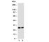 Glutathione S-Transferase Theta 1 antibody, R30954, NSJ Bioreagents, Western Blot image 