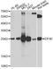 Eukaryotic Translation Initiation Factor 4E antibody, STJ23516, St John
