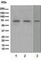 Neurofilament Light antibody, ab108363, Abcam, Western Blot image 