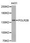 RNA Polymerase II Subunit B antibody, abx004544, Abbexa, Western Blot image 