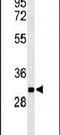 Phosphoglycolate Phosphatase antibody, PA5-26852, Invitrogen Antibodies, Western Blot image 