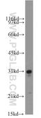 Superoxide Dismutase 3 antibody, 14316-1-AP, Proteintech Group, Western Blot image 