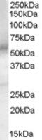 Doublecortin Domain Containing 2 antibody, 45-464, ProSci, Western Blot image 