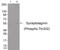 Synaptotagmin 1 antibody, 79-777, ProSci, Western Blot image 