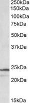 Proteasome Subunit Beta 3 antibody, orb20648, Biorbyt, Western Blot image 