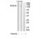 Serine/Threonine Kinase 10 antibody, TA314577, Origene, Western Blot image 