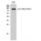 Interleukin 4 Receptor antibody, LS-C381152, Lifespan Biosciences, Western Blot image 