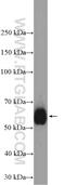 CD2 Molecule antibody, 23973-1-AP, Proteintech Group, Western Blot image 