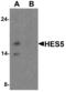 Hes Family BHLH Transcription Factor 5 antibody, MBS153653, MyBioSource, Western Blot image 