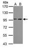 Proteasome 26S Subunit, Non-ATPase 2 antibody, PA5-27663, Invitrogen Antibodies, Western Blot image 