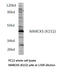 Myristoylated Alanine Rich Protein Kinase C Substrate antibody, LS-C177316, Lifespan Biosciences, Western Blot image 