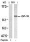 Insulin Like Growth Factor 1 antibody, orb14680, Biorbyt, Western Blot image 
