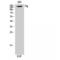 Fibroblast Growth Factor Receptor 1 antibody, LS-C383524, Lifespan Biosciences, Western Blot image 