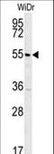 TSPY Like 4 antibody, LS-C160276, Lifespan Biosciences, Western Blot image 