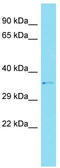 Coiled-Coil Domain Containing 159 antibody, TA334117, Origene, Western Blot image 