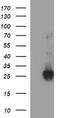 ChaC Glutathione Specific Gamma-Glutamylcyclotransferase 1 antibody, M09017, Boster Biological Technology, Western Blot image 