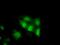 Tetratricopeptide Repeat Domain 32 antibody, GTX83486, GeneTex, Immunocytochemistry image 