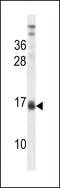 Lactalbumin Alpha antibody, A04858, Boster Biological Technology, Western Blot image 