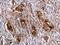 Snail Family Transcriptional Repressor 1 antibody, GTX125918, GeneTex, Immunohistochemistry paraffin image 