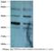 GDP Dissociation Inhibitor 2 antibody, LS-C211027, Lifespan Biosciences, Western Blot image 