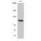 Fibroblast Growth Factor Receptor 2 antibody, LS-C382283, Lifespan Biosciences, Western Blot image 