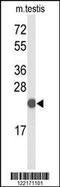 CXXC Finger Protein 4 antibody, MBS9208623, MyBioSource, Western Blot image 