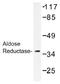 Aldose reductase antibody, AP01380PU-N, Origene, Western Blot image 