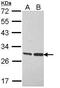 3-hydroxyacyl-CoA dehydrogenase type-2 antibody, GTX113455, GeneTex, Western Blot image 