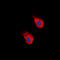 EPH Receptor A2 antibody, abx133005, Abbexa, Western Blot image 