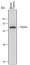 Thymocyte Selection Associated antibody, MA5-24337, Invitrogen Antibodies, Western Blot image 