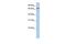 Lanosterol Synthase antibody, GTX47109, GeneTex, Western Blot image 