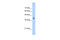 Aldolase, Fructose-Bisphosphate A antibody, 30-356, ProSci, Enzyme Linked Immunosorbent Assay image 
