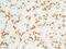 Golgi Membrane Protein 1 antibody, GTX02179, GeneTex, Immunohistochemistry paraffin image 