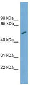 Carnosine Dipeptidase 2 antibody, TA344898, Origene, Western Blot image 