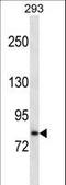Solute Carrier Family 39 Member 6 antibody, LS-C161242, Lifespan Biosciences, Western Blot image 
