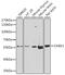 Checkpoint Kinase 1 antibody, 23-083, ProSci, Western Blot image 