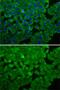 Eukaryotic Elongation Factor 2 Kinase antibody, GTX32573, GeneTex, Immunofluorescence image 