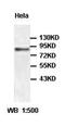 Mitogen-Activated Protein Kinase Kinase Kinase 20 antibody, orb77633, Biorbyt, Western Blot image 