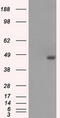 Branched Chain Keto Acid Dehydrogenase Kinase antibody, TA500685, Origene, Western Blot image 
