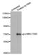 LIM Domain Kinase 2 antibody, abx000435, Abbexa, Western Blot image 