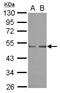 SET Domain Containing 7, Histone Lysine Methyltransferase antibody, LS-C155490, Lifespan Biosciences, Western Blot image 