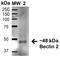 Beclin 2 antibody, orb383818, Biorbyt, Western Blot image 