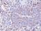 Protein Phosphatase 1 Catalytic Subunit Gamma antibody, NBP1-32858, Novus Biologicals, Immunohistochemistry paraffin image 